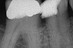 Clinical case 1a
