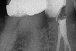 Clinical case 1b