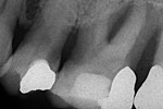 Clinical case 2a