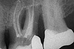 Clinical case 2b