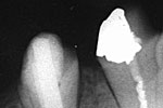 Clinical case 3a