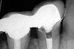Clinical case 3b