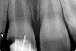 Clinical case 4a