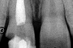Clinical case 4b