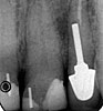 Clinical case 5a