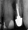Clinical case 5b