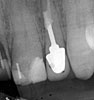 Clinical case 5c